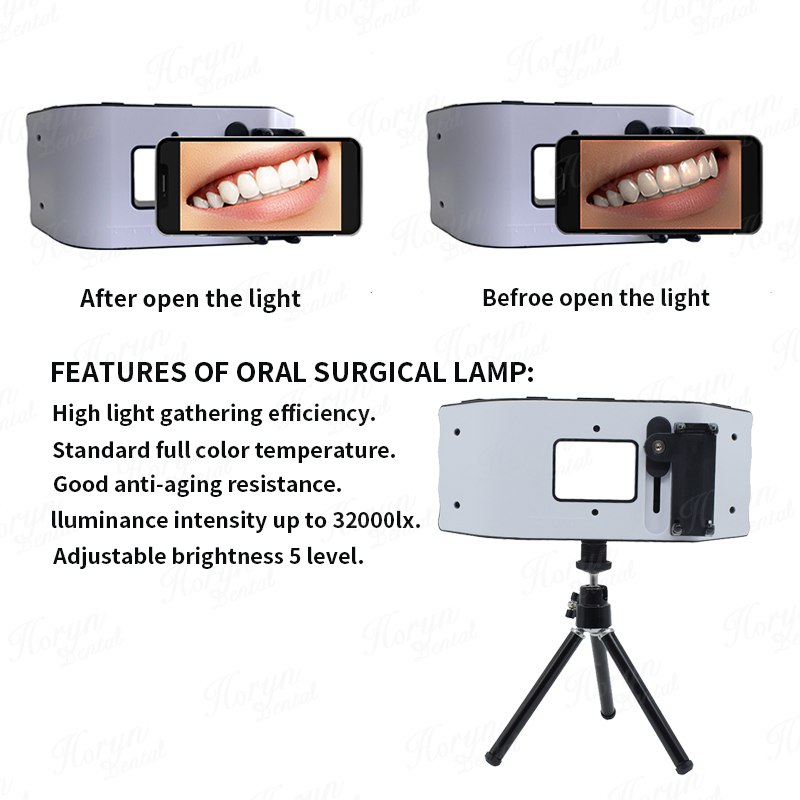 Dental Flash Light Photography - Photography Lighting Equipment recension och pris